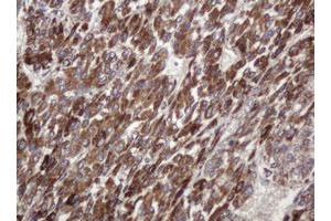 Image no. 1 for anti-TBC1 Domain Family, Member 13 (TBC1D13) antibody (ABIN1501310) (TBC1D13 抗体)
