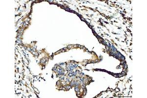 IHC analysis of CPT1A using anti-CPT1A antibody (ABIN7599853).