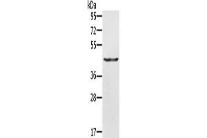 Gel: 10 % SDS-PAGE, Lysate: 30 μg, Lane: A549 cells, Primary antibody: ABIN7130044(KRT31 Antibody) at dilution 1/500, Secondary antibody: Goat anti rabbit IgG at 1/8000 dilution, Exposure time: 10 seconds (Keratin 31 抗体)