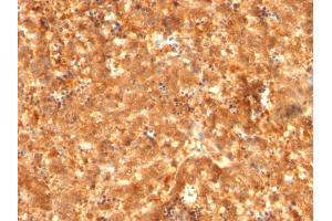 Formalin-fixed, paraffin-embedded human Fetal Liver stained with AFP Mouse Monoclonal Antibody (C2 + C3 + MBS-12). (alpha Fetoprotein 抗体)