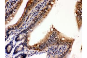 Anti- PDPK1 Picoband antibody, IHC(P) IHC(P): Mouse Intestine Tissue (PDPK1 抗体  (C-Term))