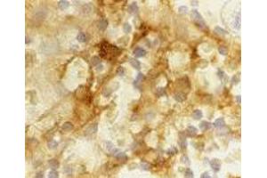 Immunohistochemistry of CD209 in human lymph node tissue with CD209 monoclonal antibody, clone 5D7  at 5 ug/mL . (DC-SIGN/CD209 抗体)