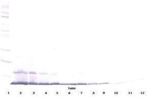 Image no. 1 for anti-Chemokine (C-C Motif) Ligand 22 (CCL22) antibody (ABIN464841) (CCL22 抗体)