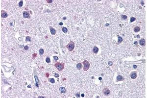 Human Brain, Cortex: Formalin-Fixed, Paraffin-Embedded (FFPE)