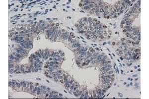 Image no. 9 for anti-ADP-Ribosylation Factor GTPase Activating Protein 1 (ARFGAP1) antibody (ABIN1496679)