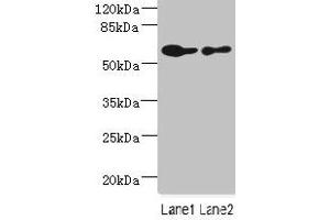 Western blot All lanes: CHRNA6 antibody at 2. (CHRNA6 抗体  (AA 26-239))