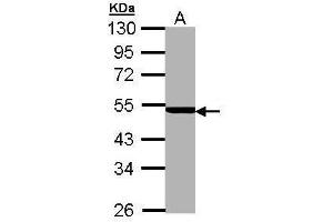 WB Image Sample (30 ug of whole cell lysate) A: MOLT4 , 10% SDS PAGE antibody diluted at 1:5000