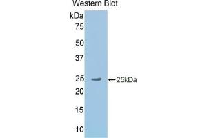 Detection of Recombinant GKN2, Rat using Polyclonal Antibody to Gastrokine 2 (GKN2) (Gastrokine 2 抗体  (AA 21-184))