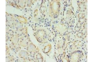 Immunohistochemistry of paraffin-embedded human pancreatic tissue using ABIN7148009 at dilution of 1:100 (COPB1 抗体  (AA 2-200))