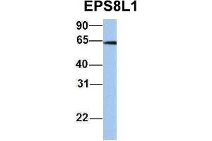Host:  Rabbit  Target Name:  EPS8L1  Sample Type:  Jurkat  Antibody Dilution:  1. (EPS8-Like 1 抗体  (Middle Region))