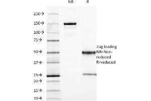 SDS-PAGE Analysis Purified CEA Mouse Monoclonal Antibody (C66/1009). (CEACAM5 抗体)