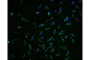 Immunofluorescence staining of U251 cells with ABIN7152226 at 1:100, counter-stained with DAPI. (SLC1A3 抗体  (AA 146-236))