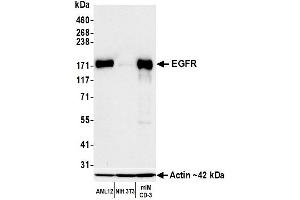 Western Blotting (WB) image for anti-Epidermal Growth Factor Receptor (EGFR) (C-Term) antibody (ABIN7795642)
