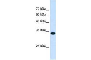 Image no. 2 for anti-Solute Carrier Family 25, Member 38 (SLC25A38) (AA 101-150) antibody (ABIN6736660) (SLC25A38 抗体  (AA 101-150))