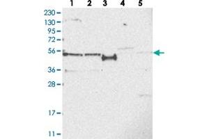 Western blot analysis of Lane 1: RT-4, Lane 2: U-251 MG, Lane 3: Human Plasma, Lane 4: Liver, Lane 5: Tonsil with SLCO4A1 polyclonal antibody . (SLCO4A1 抗体)