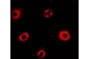 Immunofluorescent analysis of eIF4A1 staining in MCF7 cells. (EIF4A1 抗体)