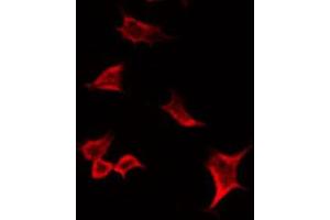 ABIN6266594 staining HuvEc by IF/ICC. (MMP19 抗体  (N-Term))