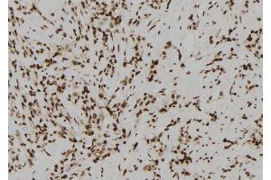 ABIN6272236 at 1/100 staining Human gastric tissue by IHC-P. (Acrosin 抗体  (N-Term))