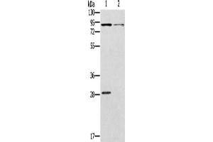 Gel: 8 % SDS-PAGE, Lysate: 40 μg, Lane 1-2: Mouse kidney tissue, Mouse brain tissue, Primary antibody: ABIN7128983(CNGA3 Antibody) at dilution 1/500, Secondary antibody: Goat anti rabbit IgG at 1/8000 dilution, Exposure time: 2 minutes (CNGA3 抗体)