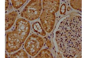 IHC image of ABIN7165952 diluted at 1:100 and staining in paraffin-embedded human kidney tissue performed on a Leica BondTM system. (PPM1J 抗体  (AA 294-505))