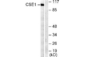 Western blot analysis of extracts from 293 cells, using CSantibody. (Exportin 2 抗体)