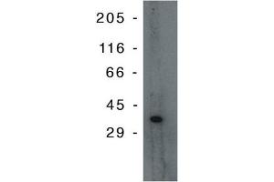 Western Blotting (WB) image for anti-Tumor Protein P53 Inducible Protein 3 (TP53I3) antibody (ABIN264400) (TP53I3 抗体)