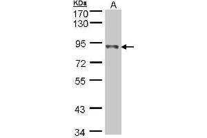 Western Blotting (WB) image for anti-NADH Dehydrogenase (Ubiquinone) Fe-S Protein 1, 75kDa (NADH-Coenzyme Q Reductase) (NDUFS1) (Center) antibody (ABIN2856074)
