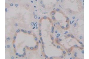 Detection of ADAM10 in Human Kidney Tissue using Polyclonal Antibody to A Disintegrin And Metalloprotease 10 (ADAM10) (ADAM10 抗体  (AA 420-641))