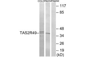 Western blot analysis of extracts from COLO cells and HepG2 cells, using TAS2R49 antibody. (TAS2R20 抗体  (Internal Region))