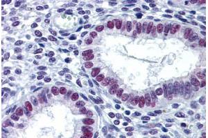 Human Uterus: Formalin-Fixed, Paraffin-Embedded (FFPE) (LSD1 抗体  (AA 753-852))
