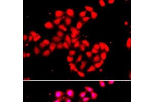 Immunofluorescence analysis of A549 cells using CAMK1D Polyclonal Antibody (CAMK1D 抗体)
