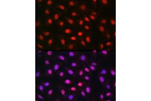 Immunofluorescence analysis of U-2 OS cells using MDC1 Rabbit pAb (ABIN6134688, ABIN6143659, ABIN6143661 and ABIN6216452) at dilution of 1:150 (40x lens). (MDC1 抗体  (AA 1-100))