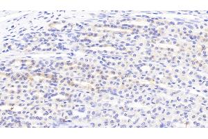 Detection of SLC in Rat Stomach Tissue using Polyclonal Antibody to Secondary Lymphoid Tissue Chemokine (SLC) (CCL21 抗体  (AA 5-132))