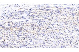Detection of SLC in Rat Stomach Tissue using Polyclonal Antibody to Secondary Lymphoid Tissue Chemokine (SLC) (CCL21 抗体  (AA 5-132))
