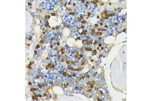 Immunohistochemistry (IHC) image for anti-Cathelicidin Antimicrobial Peptide (CAMP) (AA 31-170) antibody (ABIN7266146)