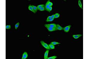 Immunofluorescent analysis of HepG2 cells using ABIN7156533 at dilution of 1:100 and Alexa Fluor 488-congugated AffiniPure Goat Anti-Rabbit IgG(H+L) (ICAM1 抗体  (AA 320-480))