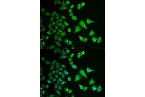 Immunofluorescence analysis of HeLa cells using DHRS2 antibody. (DHRS2 抗体  (AA 1-300))