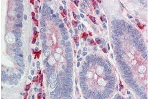 Human Small Intestine: Formalin-Fixed, Paraffin-Embedded (FFPE) (Claudin 6 抗体  (Val118))