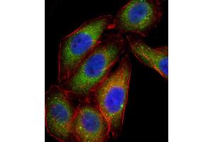 Immunofluorescence (IF) image for anti-Mitogen-Activated Protein Kinase 14 (MAPK14) antibody (ABIN2996778) (MAPK14 抗体)