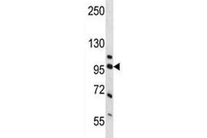 Western blot analysis of NCL and human placenta tissue lysate.