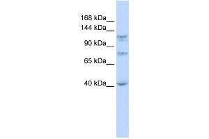 DHX30 antibody used at 1 ug/ml to detect target protein. (DHX30 抗体)