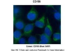 Researcher: Dr. (Poliovirus Receptor 抗体  (N-Term))