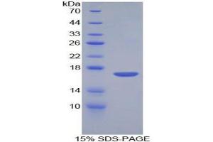 SDS-PAGE analysis of Mouse Corin Protein. (Corin 蛋白)