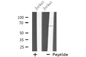 Western blot analysis of extracts from Jurkat cells, using THAS antibody. (TBXAS1 抗体  (N-Term))
