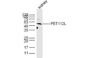 Mouse kidney lysates probed with PET112L Polyclonal Antibody, unconjugated  at 1:300 overnight at 4°C followed by a conjugated secondary antibody at 1:10000 for 60 minutes at 37°C. (PET112L 抗体  (AA 101-200))