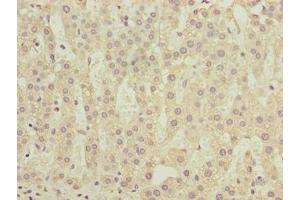 Immunohistochemistry of paraffin-embedded human adrenal gland tissue using ABIN7148308 at dilution of 1:100 (COMMD2 抗体  (AA 5-199))