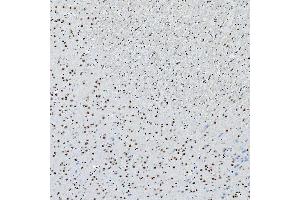 IHC analysis of SNRNP200 using anti-SNRNP200 antibody (ABIN7602032). (SNRNP200 抗体  (AA 557-2129))