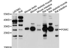 Western blot analysis of extracts of various cell lines, using POMC antibody (ABIN5971555) at 1/1000 dilution. (ACTH 抗体)