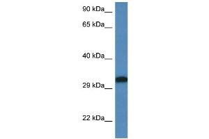 WB Suggested Anti-Dlx6 Antibody   Titration: 1.