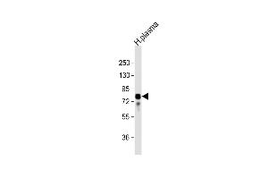 Anti-VTN Antibody (N-term) at 1:32000 dilution + human plasma lysate Lysates/proteins at 20 μg per lane.